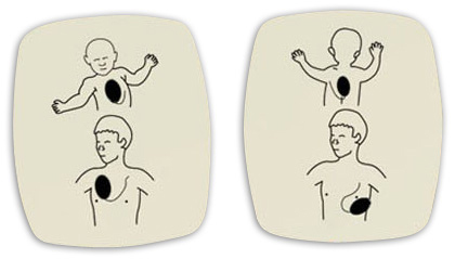 aed pads child cpr